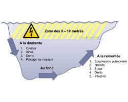 Les barotraumatismes (Les risques et les accidents en plongée)